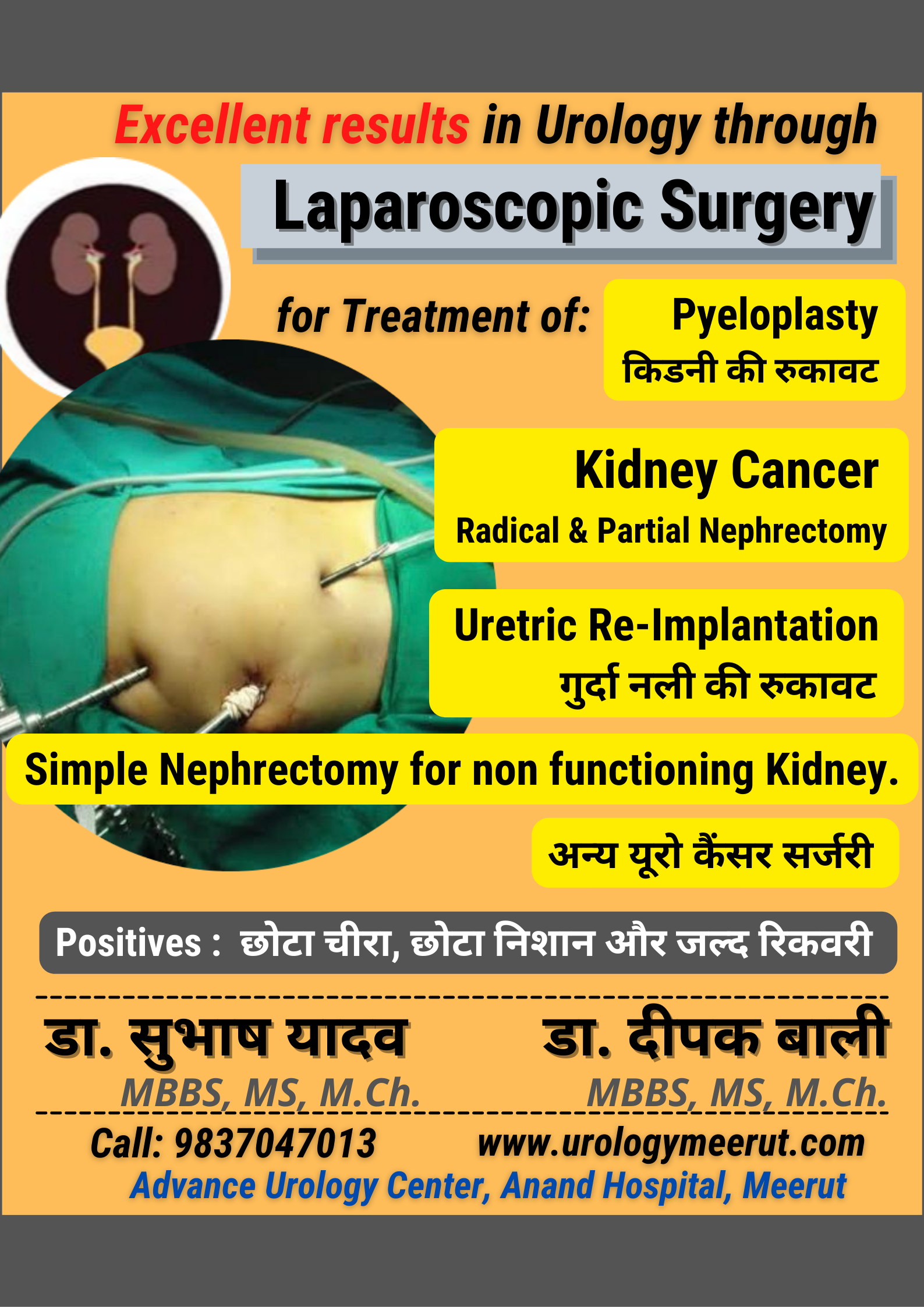 Laparoscopic Surgery in Meerut