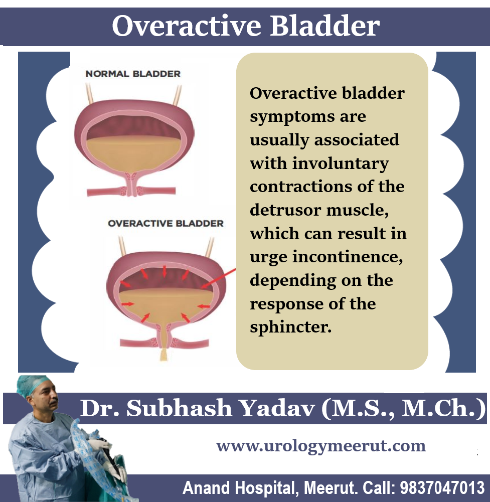 Overactive Bladder Treatment in Meerut